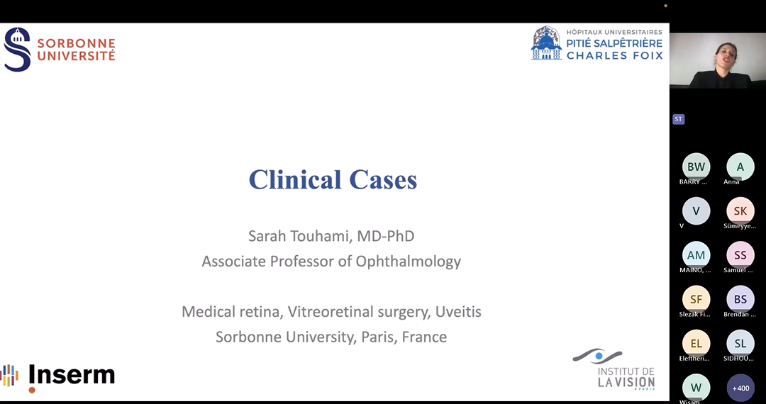 Posterior uveitis - Sarah Touhami